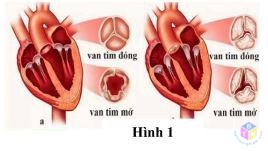 van tim